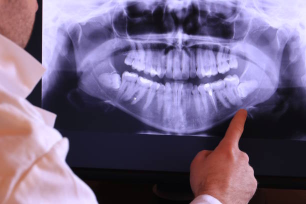 Best Emergency Treatment for Jaw Pain or Injury in Gloverville, SC