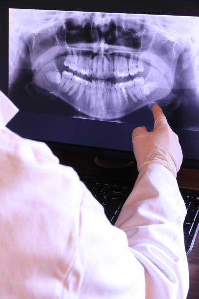 Best Knocked-Out Tooth (Avulsed Tooth) Treatment in Gloverville, SC