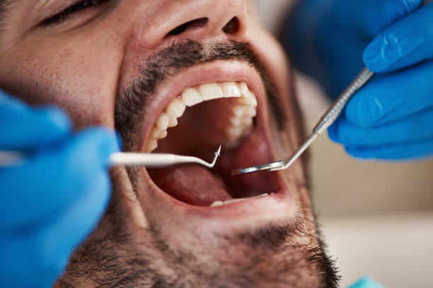 Best Dental Abscess Treatment in Gloverville, SC