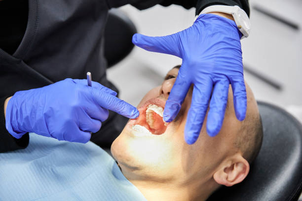 Best Emergency Wisdom Tooth Extraction in Gloverville, SC